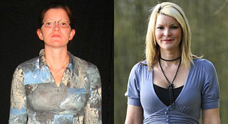 plastic-surgery-extreme-makeover