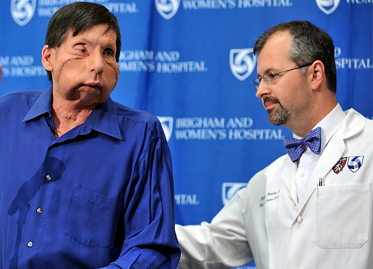 Face transplant patient James Maki with Dr. Bohdan Pomahac