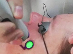 surgical-laser-minimizes-bruising