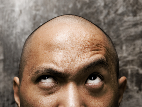 Botox may be cure for baldness