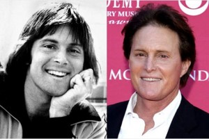 bruce-jenner-before-and-after