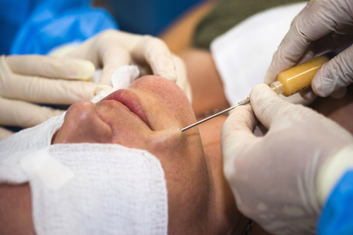 fat injections for facial trauma patients