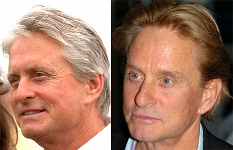 michael douglas face lift rumors