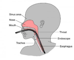Endoscopy1ff