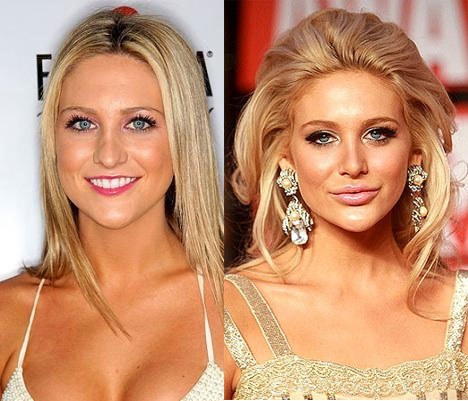 Stephanie-Pratt-before-and-after