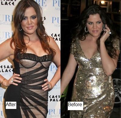 Khloe Kardashian