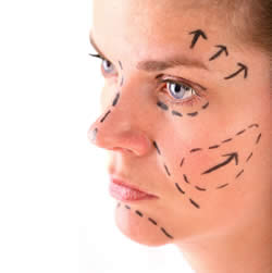 laser tightening