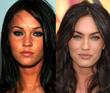 megan-fox-before-and-after