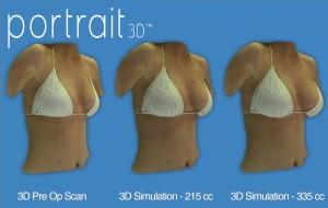 3d breast imaging