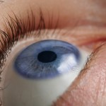 blepharoplasty or eyelid surgery