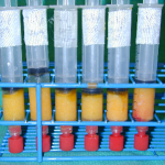 lipo-injection breast injection
