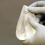 cohesive gel implants