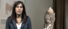Breast Augmentation Revision | Plastic Surgery Channel Breast Augmentation Revision | Plastic Surgery Channel