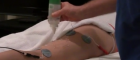 Non-surgical fat removal Non-surgical fat removal